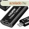 HDMI vidergzt - USB