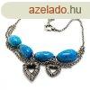 Ni nyaklnc Folli Follie 4N0T051KU 25 cm MOST 61874 HELYETT