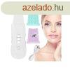 Ultrahangos arctisztt kavitcis peeling akusztikus