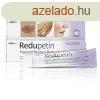 Redupetin dermatolgiai specilis kencs 20 ml