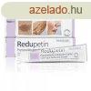Redupetin dermatolgiai specilis kencs 20 ml