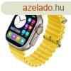 Ultra watch srga - Emeld ki stlusodat ezzel az egyedlll