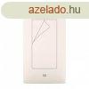 Xiaomi Redmi Note 4 kpernyvd flia