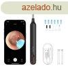 Smart Visual Ear-Clean Rod Xlife X1 (fekete)