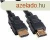 BLACKBIRD Kbel HDMI male/male sszekt 2K 3m, Fekete