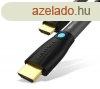 Vention HDMI ( aktv, fekete), 1m, kbel