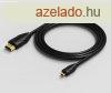 Vention Micro HDMI/M -> HDMI/M 2m cable Black