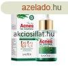 Sadoer Tea Tree Acnes Oil Control Face Serum pattans elleni